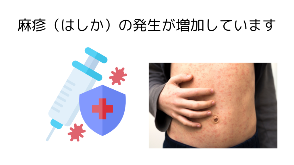 麻疹(はしか)の発生が増加しています | 森嶋クリニック